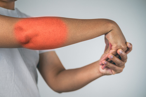 exercises for golfers elbow